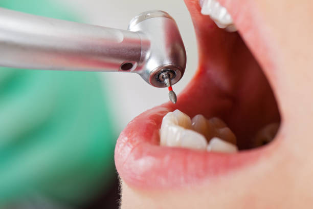 Best Emergency Dentist for Knocked-Out Tooth in Birch Run, MI